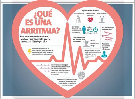 arritmia cardiaca tratamiento natural